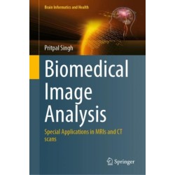 Biomedical Image Analysis: Special Applications in MRIs and CT scans