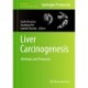 Liver Carcinogenesis: Methods and Protocols