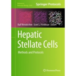 Hepatic Stellate Cells: Methods and Protocols