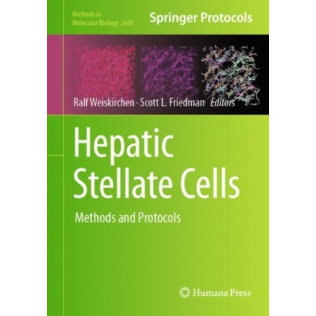 Hepatic Stellate Cells: Methods and Protocols