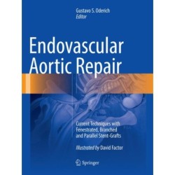 Endovascular Aortic Repair: Current Techniques with Fenestrated, Branched and Parallel Stent-Grafts