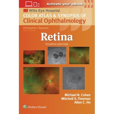Retina