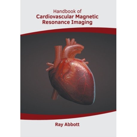 Handbook of Cardiovascular Magnetic Resonance Imaging