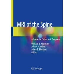 MRI of the Spine: A Guide for Orthopedic Surgeons