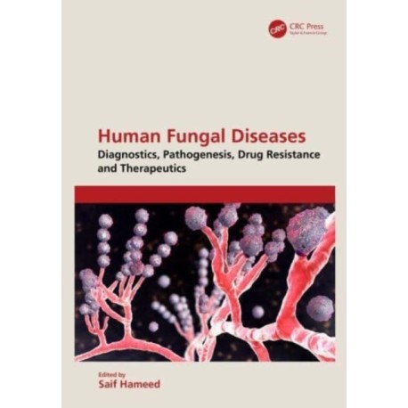 Human Fungal Diseases: Diagnostics, Pathogenesis, Drug Resistance and Therapeutics