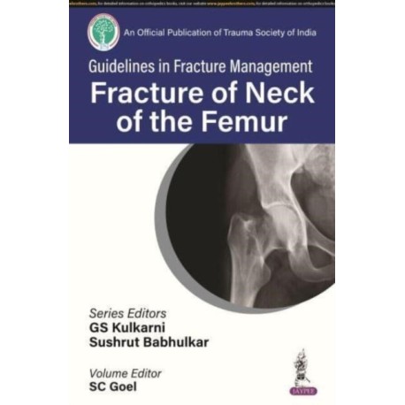 Guidelines in Fracture Management: Fracture of the Neck of the Femur
