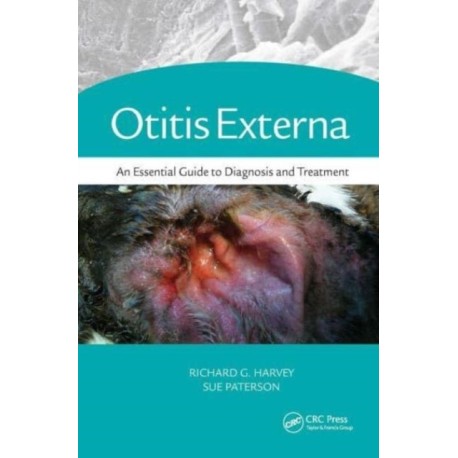 Otitis Externa: An Essential Guide to Diagnosis and Treatment