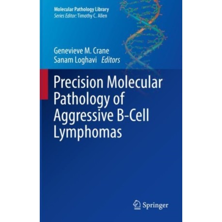 Precision Molecular Pathology of Aggressive B-Cell Lymphomas