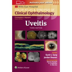 Uveitis
