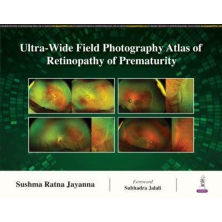 Ultra-Wide Field Photography Atlas of Retinopathy of Prematurity