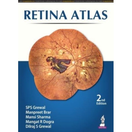 Retina Atlas