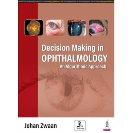 Decision Making in Ophthalmology: An Algorithmic Approach