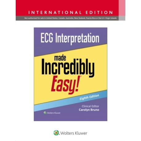 ECG Interpretation Made Incredibly Easy!