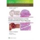Biopsy Interpretation of the Gastrointestinal Tract Mucosa Volume 2: Neoplastic: Print + eBook with Multimedia