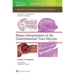 Biopsy Interpretation of the Gastrointestinal Tract Mucosa Volume 2: Neoplastic: Print + eBook with Multimedia