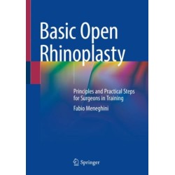 Basic Open Rhinoplasty: Principles and Practical Steps for Surgeons in Training