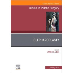 Blepharoplasty, An Issue of Clinics in Plastic Surgery