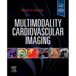 Multimodality Cardiovascular Imaging