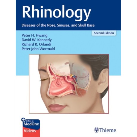 Rhinology: Diseases of the Nose, Sinuses, and Skull Base