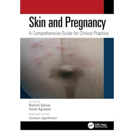 Skin and Pregnancy: A Comprehensive Guide for Clinical Practice