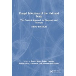 Fungal Infections of the Nail and Scalp: The Current Approach to Diagnosis and Therapy