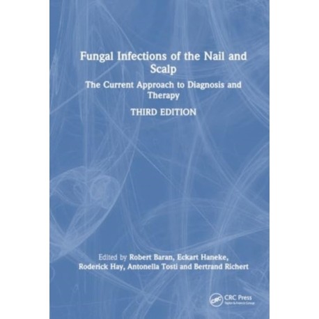 Fungal Infections of the Nail and Scalp: The Current Approach to Diagnosis and Therapy