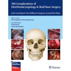 100 Complications of Otorhinolaryngology & Skull Base Surgery: Each Case Report from Different Surgeons Around the Globe