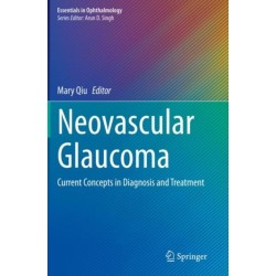 Neovascular Glaucoma: Current Concepts in Diagnosis and Treatment