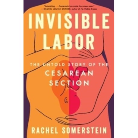 Invisible Labor: The Untold Story of the Cesarean Section