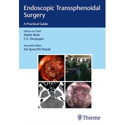 Endoscopic Transsphenoidal Surgery: A Practical Guide
