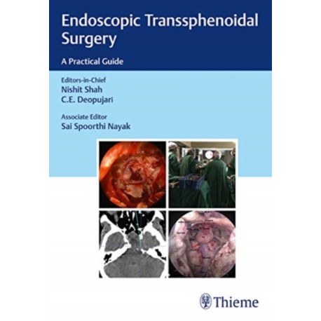 Endoscopic Transsphenoidal Surgery: A Practical Guide