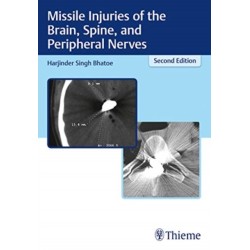 Missile Injuries of the Brain, Spine, and Peripheral Nerves