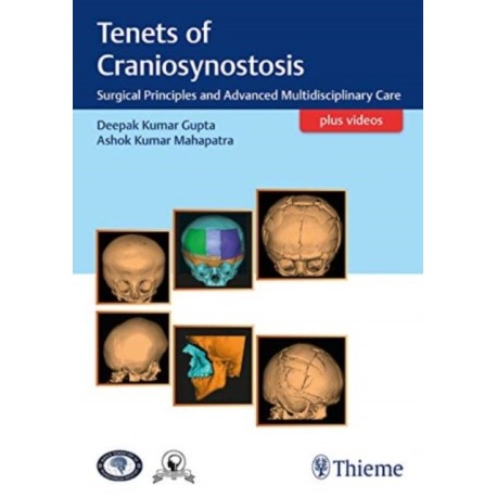 Tenets of Craniosynostosis: Surgical Principles and Advanced Multidisciplinary Care