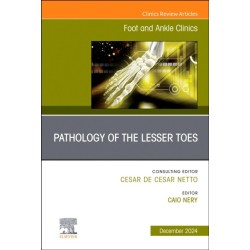 Pathology of the Lesser Toes, An issue of Foot and Ankle Clinics of North America