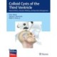 Colloid Cysts of the Third Ventricle: Natural History, Decision-Making, and Operative Management