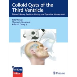 Colloid Cysts of the Third Ventricle: Natural History, Decision-Making, and Operative Management