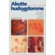 Akutte hudsygdomme