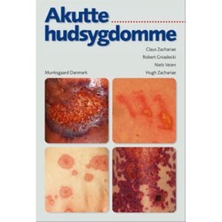 Akutte hudsygdomme
