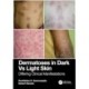 Dermatoses in Dark Vs Light Skin: Differing Clinical Manifestations