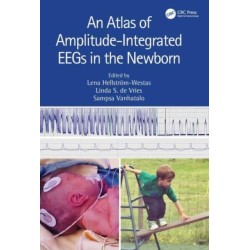 An Atlas of Amplitude-Integrated EEGs in the Newborn