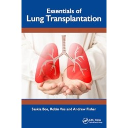 Essentials of Lung Transplantation