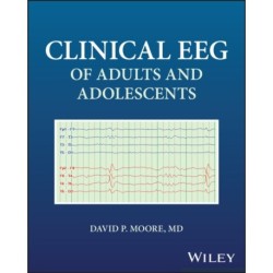 Clinical EEG of Adults and Adolescents