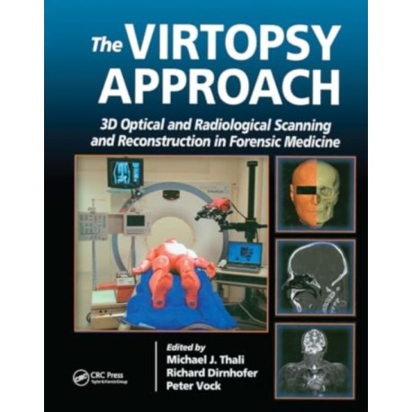 The Virtopsy Approach: 3D Optical and Radiological Scanning and Reconstruction in Forensic Medicine