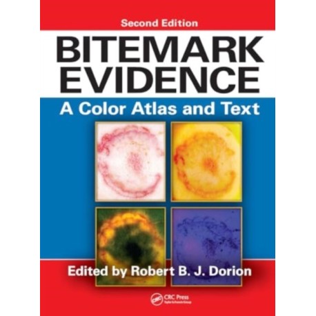 Bitemark Evidence: A Color Atlas and Text, 2nd Edition