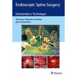 Endoscopic Spine Surgery: Destandau's Technique