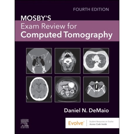 Mosby's Exam Review for Computed Tomography