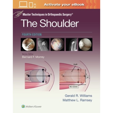 Master Techniques in Orthopaedic Surgery: The Shoulder: Print + eBook with Multimedia