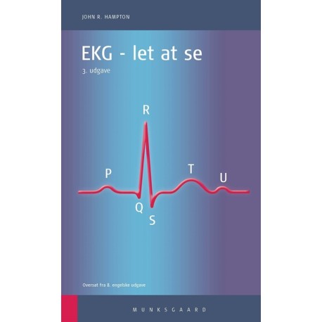 EKG: - let at se