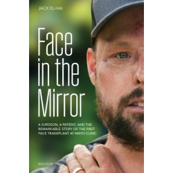 Face Transplant: How Medical Science Gave a Man a New Face and Restored His True Identity