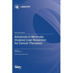 Advances in Minimally Invasive Liver Resection for Cancer Therapies